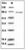 Alkaline Phosphatase/ALPL Protein, Human, Recombinant (His)