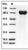 Influenza A H5N1 (A/Hong Kong/483/1997) Hemagglutinin/HA Protein (His)