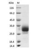 SOST Protein, Human, Recombinant (His)