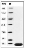 B2M/beta 2-Microglobulin Protein, Human, Recombinant (His)