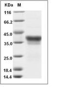 IL-34 Protein, Human, Recombinant (His)