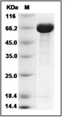 BirA Protein, E. coli, Recombinant (His & MBP)