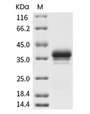 FOLR1 Protein, Cynomolgus, Rhesus, Recombinant (His)