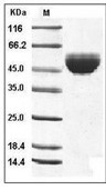 GM-CSF/CSF2 Protein, Human, Recombinant (hFc)
