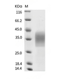 TREM-2 Protein, Mouse, Recombinant (His)