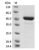 Human coronavirus (HCoV-229E) Nucleocapsid Protein (His)
