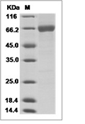 Influenza B (B/PHUKET/3073/2013) Hemagglutinin/HA Protein (His)