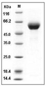 DDR1 Protein, Human, Recombinant (His)