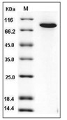 Transglutaminase 2/TGM2 Protein, Human, Recombinant (His)