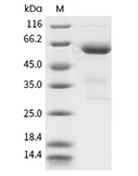 CD73/5'-Nucleotidase Protein, Human, Recombinant (His)