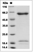 PCSK9 Protein, Human, Recombinant (D374Y & V474I & G670E, His)