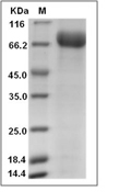 Influenza A H3N2 (A/Hong Kong/4801/2014) Neuraminidase/NA Protein (His)