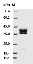 IL-17A & IL-17F Heterodimer Protein, Human, Recombinant (His)