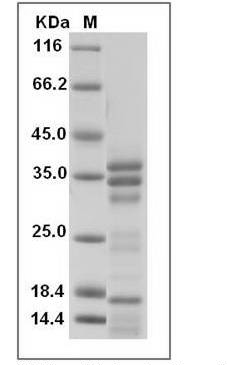 Der p 1 Protein, Dermatophagoides pteronyssinus, Recombinant (His)