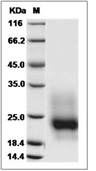GM-CSF/CSF2 Protein, Mouse, Recombinant (His)