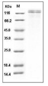 VLDLR Protein, Human, Recombinant (His)