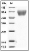 TrkA Protein, Human, Recombinant (His)