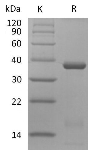 IL-15RA & IL-15 Protein, Human, Recombinant - PBS Lyophilized (hFc)