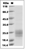 TGFBR2 Protein, Human, Recombinant (His)
