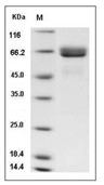Alkaline phosphatase Protein, Human, Recombinant (His)