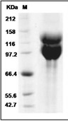 Integrin alpha V beta 6 Protein, Human, Recombinant (Flag & His)