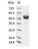 Carbonic Anhydrase 9 Protein, Human, Recombinant (His)