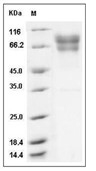 Coagulation factor IX/F9 Protein, Human, Recombinant (His)