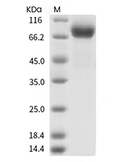 Influenza B (B/Washington/02/2019) Hemagglutinin/HA Protein (His)