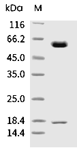 PCSK9 Protein, Human, Recombinant (D374Y, His)