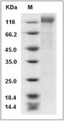 HIV-1 (group M, subtype CRF07_BC) gp140 Protein (His)