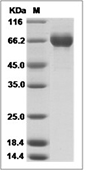 Influenza A H3N2 (A/Wuhan/359/1995) Hemagglutinin/HA Protein (His)