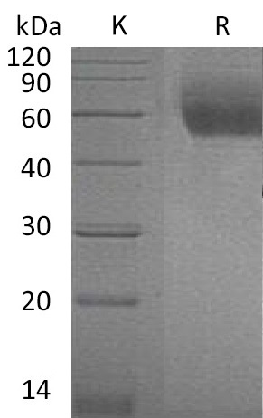 ST2/IL-1 RL1 Protein, Mouse, Recombinant (aa 27-337, His)