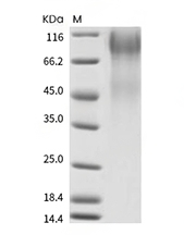 Human respiratory syncytial virus (RSV) (A, rsb1734) glycoprotein G/RSV-G Protein (95% Homology) (His)