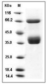 RON/CD136 Protein, Human, Recombinant (His)