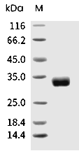 ANGPT2/Angiopoietin-2 Protein, Mouse, Recombinant (His)