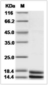 S100A8 & S100A9 Heterodimer Protein, Human, Recombinant (Flag & His)