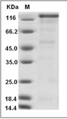Cadherin 17/CDH17 Protein, Cynomolgus, Recombinant (hFc)