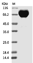 Influenza A H1N1 (A/Brisbane/02/2018) Hemagglutinin/HA Protein (His)