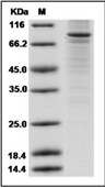 PPAR gamma/PPARG Protein, Human, Recombinant (His & GST)