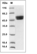 RAGE Protein, Human, Recombinant (His)