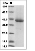 KIR3DL3 Protein, Human, Recombinant (His)