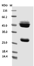 IL-12 Protein, Mouse, Recombinant (His)
