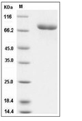 Transferrin Protein, Human, Recombinant (His)