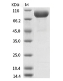 IL-1R1 Protein, Human, Recombinant (hFc)