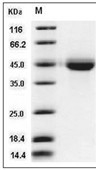 VSIG4 Protein, Human, Recombinant (His)