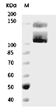 Integrin alpha V beta 3 Protein, Human, Recombinant (His)
