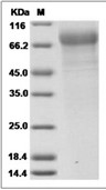 Influenza A H3N2 (A/Aichi/2/1968) Neuraminidase/NA Protein (His)