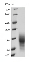 TIGIT Protein, Mouse, Recombinant (His)