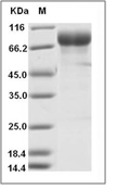 Influenza A H1N1 (A/Michigan/45/2015) Hemagglutinin/HA Protein (His)