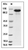 HER3/ERBB3 Protein, Rhesus, Recombinant (His)